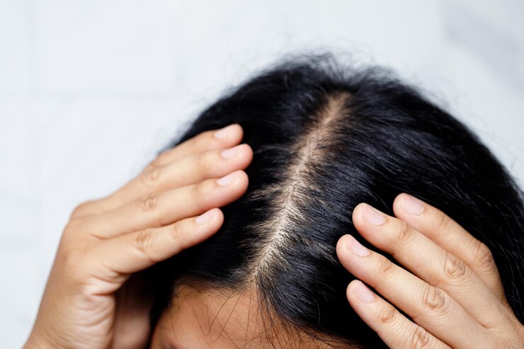 how to exfoliate your scalp