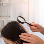 dandruff vs. dry scalp