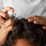 maintain scalp health