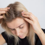 what causes a dry scalp