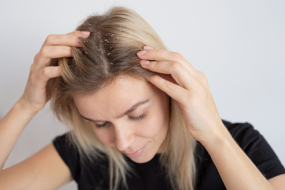 what causes a dry scalp