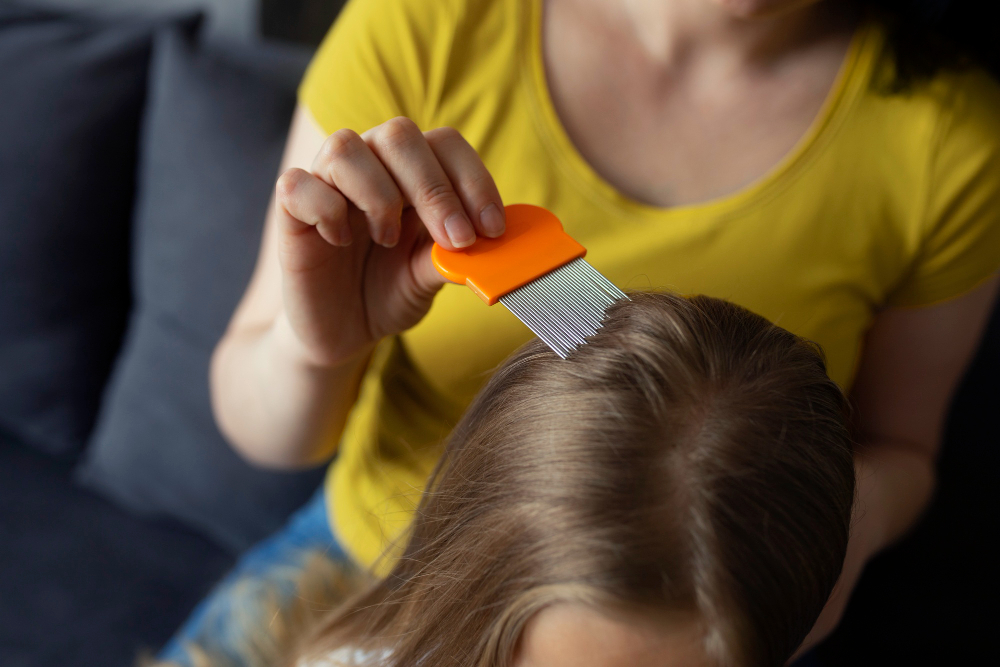scalp conditions head lice