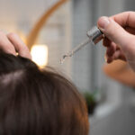 scalp treatment for hair loss